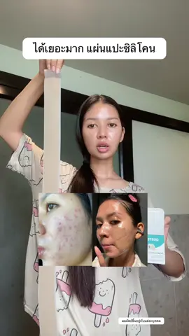 ลอง ลอง ลอง ✅✨ #แผ่นแปะซิลิโคน #แผ่นแปะซิลิโคนเจล #ใช้ดีบอกต่อ #ป้ายยาtiktok #ส้มโอที่หน้าเป็นสิว  