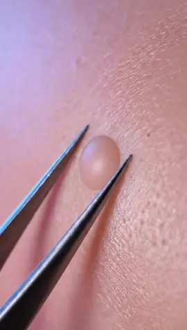 Taffy pimple pop 🍬🫧 Sticky pull, smooth stretch, and perfectly satisfying ASMR. #ASMR #Slime #Satisfying #OddlySatisfying #AI