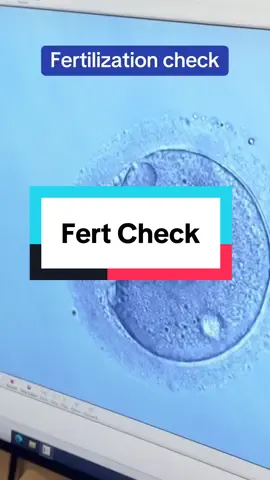 We checked every egg carefully to see if there was normal Fertilization.  #ivf #Science #eggs  #behindthescenes #fertility @fertilitycentersofil 