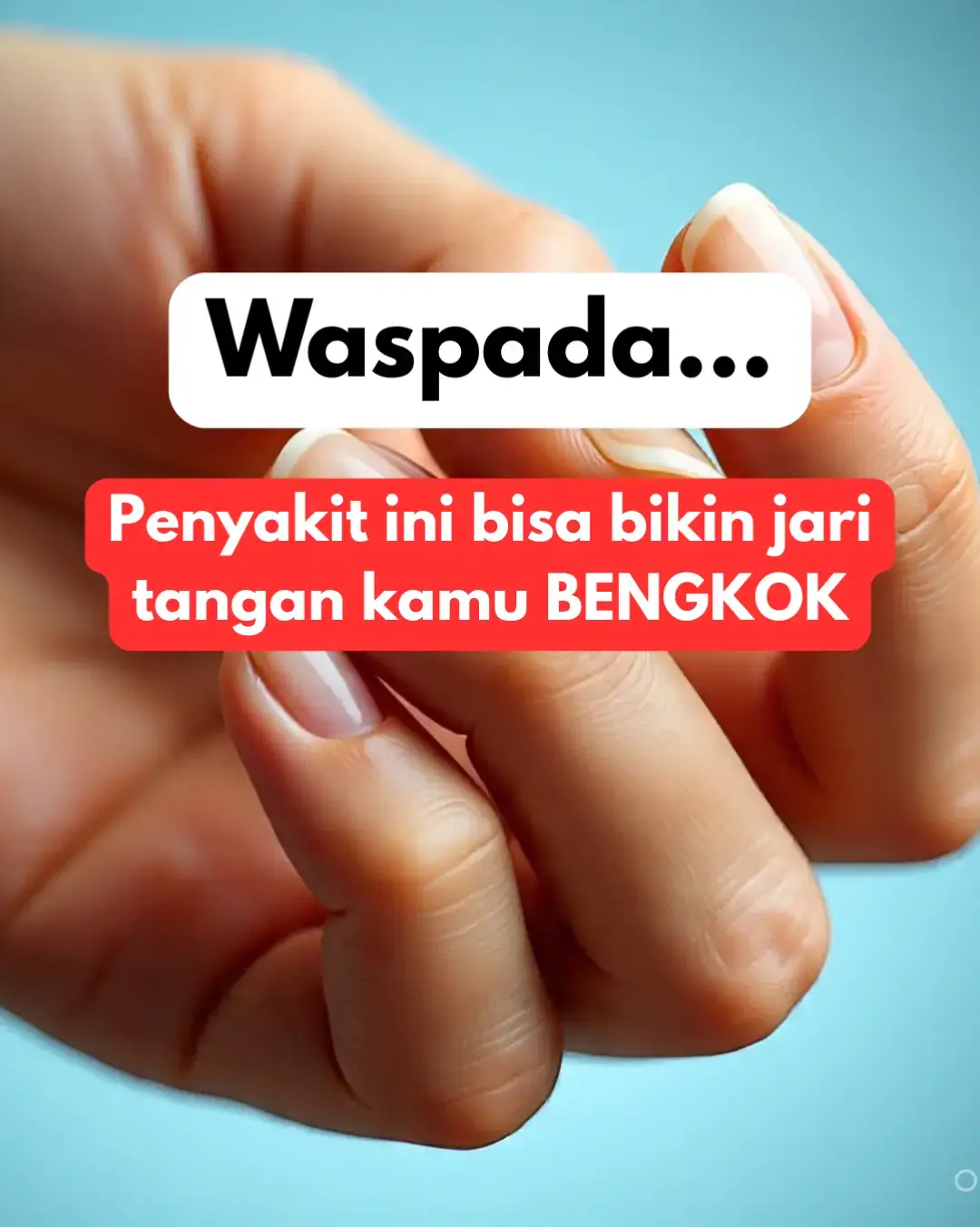 Waspada ⚠️ Kalau jari tangan kamu mulai tampak bengkok, menonjol, atau terasa nyeri saat digerakkan, bisa jadi itu tanda radang sendi yang sudah merusak jaringan di dalamnya. 📍Saat peradangan terjadi terus-menerus, sendi di jari mengalami pembengkakan dan kerusakan pada tulang rawan. Lama-kelamaan bentuk jari bisa berubah, sulit diluruskan, bahkan terasa kaku setiap pagi. Gejala ini nggak boleh dibiarkan, karena kalau dibiarkan terlalu lama bisa menyebabkan kerusakan sendi permanen. Tapi kabar baiknya, kondisi ini bisa dipulihkan secara bertahap dengan pola makan antiinflamasi dan terapi nutrisi yang tepat 💪 💬 DM atau inbox sekarang kalau kamu ingin tahu cara pulih alami tanpa obat kimia, bantu redakan nyeri, dan kembalikan fungsi sendi secara alami lewat terapi nutrisi.