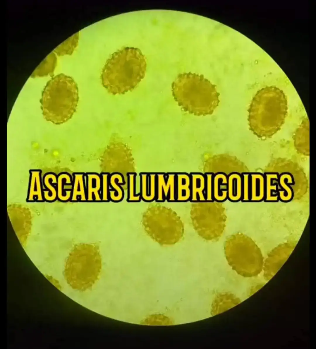 un pequeño atlas parásitologico para poder recordar la morfología parásitaria #estudiantesdebioquimica👩‍⚕🔬🧫 #bioquimicayfarmaciaudabol🇧🇴 #laboratorioclínico #bioquimica #bioquimicayfarmacia👩‍🔬👩‍🔬👩‍🔬 