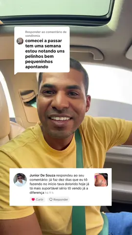 Respondendo a @xandinmia  #fyp #fypシ゚viral #altoestima #alopecia #crescimentocapilar 