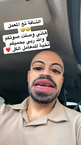 عرفي في المعمل #الشعب_الصيني_ماله_حل😂🤣اكسبلور #الشعب_الصيني_ماله_حل😂🤣اكسبلور #viral #مشاهير 