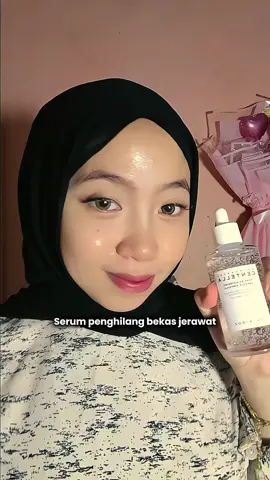 Serum andalan aku saat acne @skin1004_indonesia karena cocok utk sensitive skin #skin1004viral #skin1004 #skin1004serum 