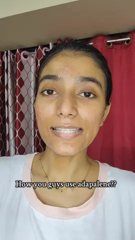 help minnahhhh #adapalene #oinment #acne #pharmacy #acne 