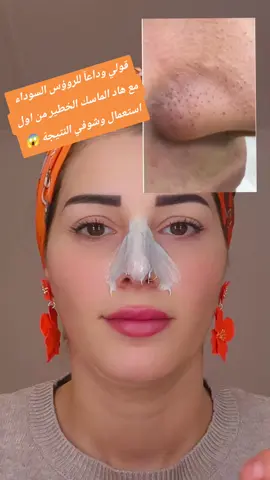 قولي وداعآ للرؤوس السوداء على الأنف👃✅ومن أول استعمال نتيجة مضمونه #نصائح #skincare #رؤوس_سوداء #foreyou #عناية_بالبشرة 