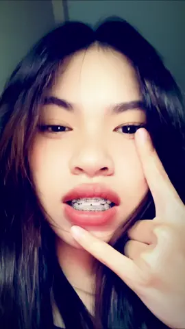 Ot mean braces zin eh mean tah braces Ai #wlw  