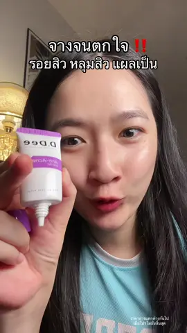 รอยสิวเยอะ ใช้ด่วน ผิวอ่อนแอแพ้ง่ายใช้ได้ #รอยสิว #เจลรอยสิว #DDee #TikTokShopMallบอกต่อ #ป้ายยาเฮลตี้ 