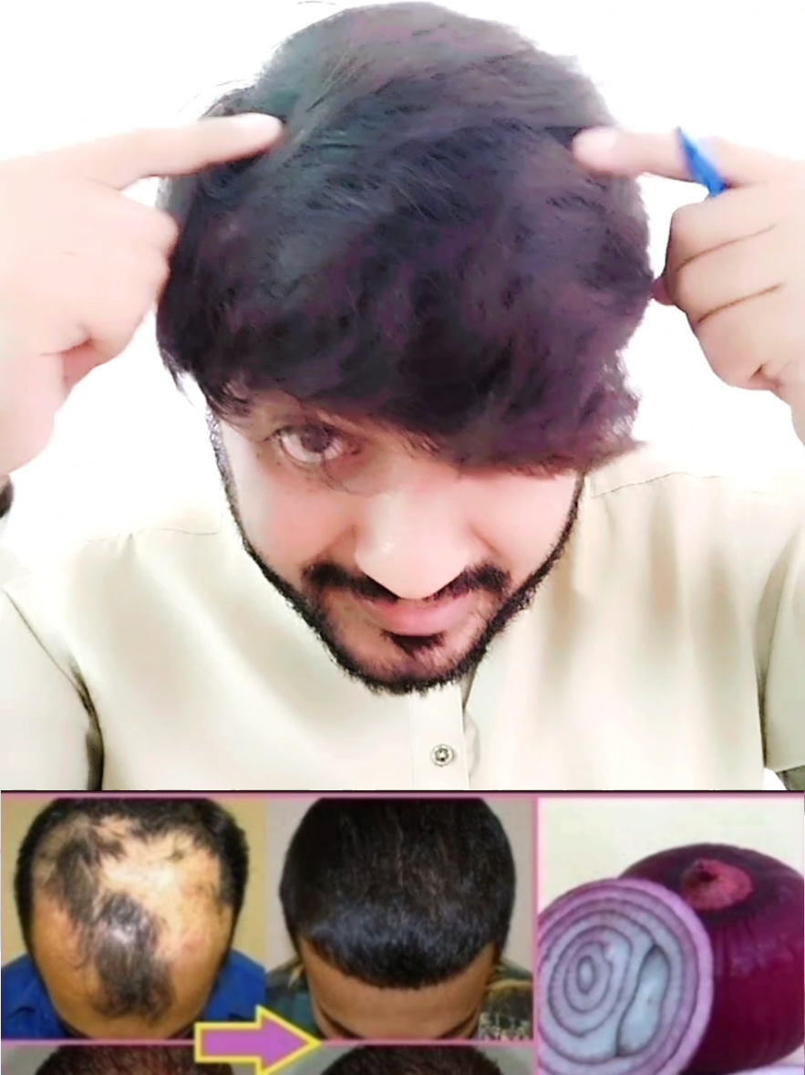 Unlock Your Scalp's Potential with Hair Oil #hairoil #hairgrowth #hairfall  #hairtips #haircare 