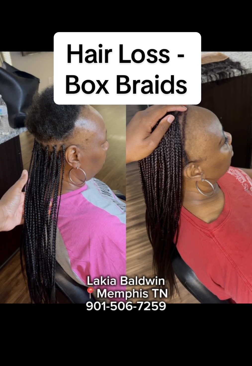 Returning new client 💕Hair Loss Coverup with frontal ! I have some big announcements coming soon for all of my hair loss clients 😎🎉 stay tuned! #makeover #hairloss #transformation #HairLossSolution #coverup #creatorsearchinsights #bignewscoming