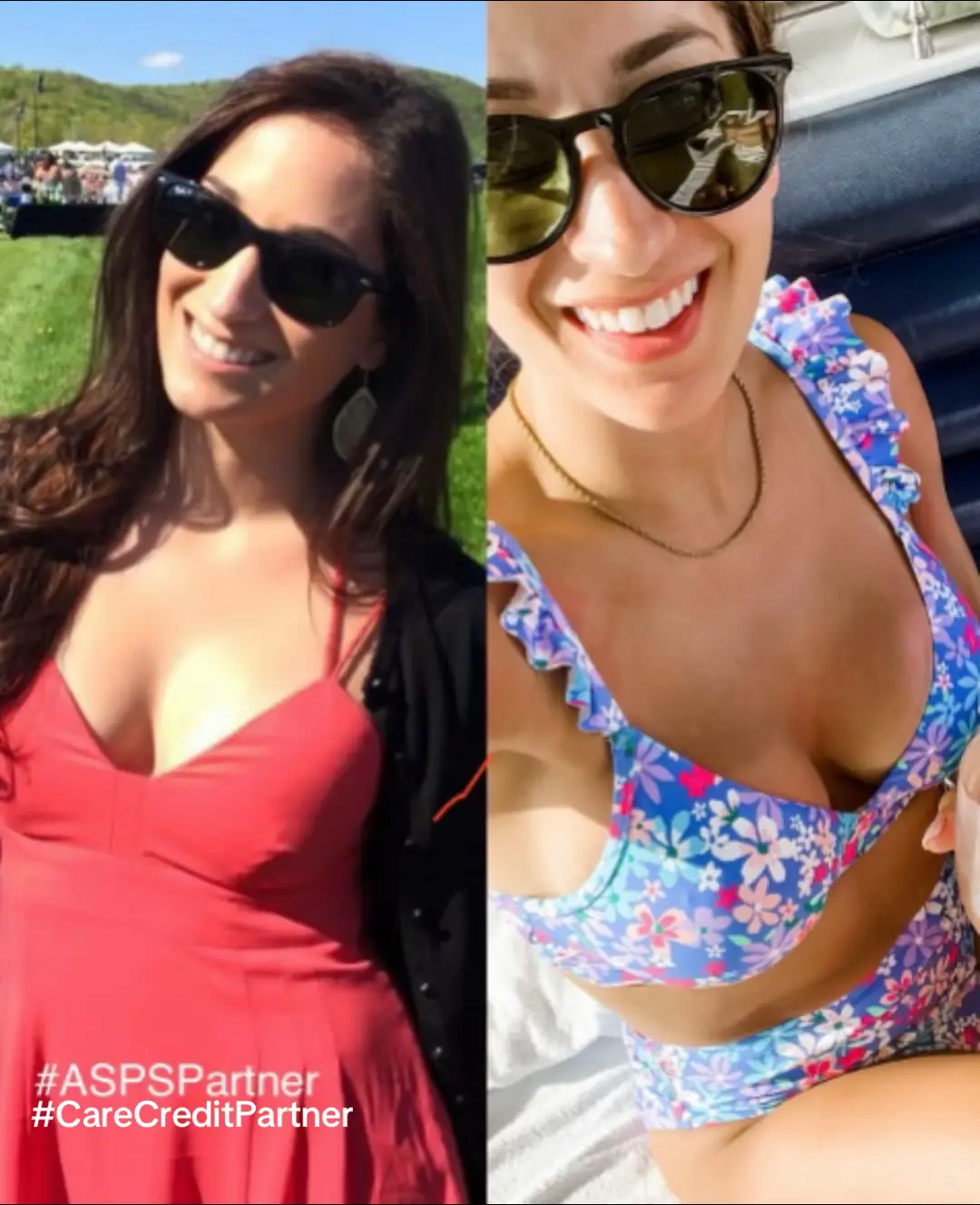 #ASPSPartner What's the key to having a natural look after plastic surgery? Booking with an ASPS Member board certified plastic surgeon who listens to what you're looking for and is able to provide you with a natural enhancement that will enhance your look, not take it over! Interested in plastic surgery? Download ASPS free e-book to guide your plastic surgery journey! #ad @American Soc Plastic Surgeons @carecredit #TheCareYouDeserve #PlasticSurgery #CareCreditPartner