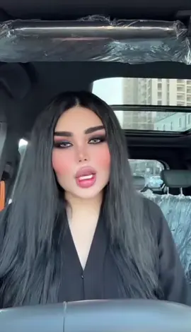 #tiktok #slimane #hawler #fyp #🐎 