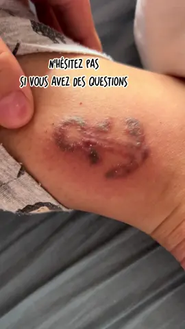 #CapCut Je vous raconte🗣️ #detatouage #tatouages #tattoos #detatoo 