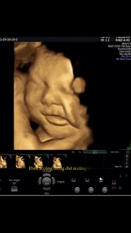 sắp được gặp ẻm ruiiii🫶😋