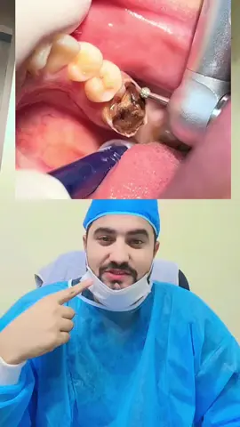 #creatorsearchinsights #teethwhitening #teethcare #information #foryoupageofficiall 