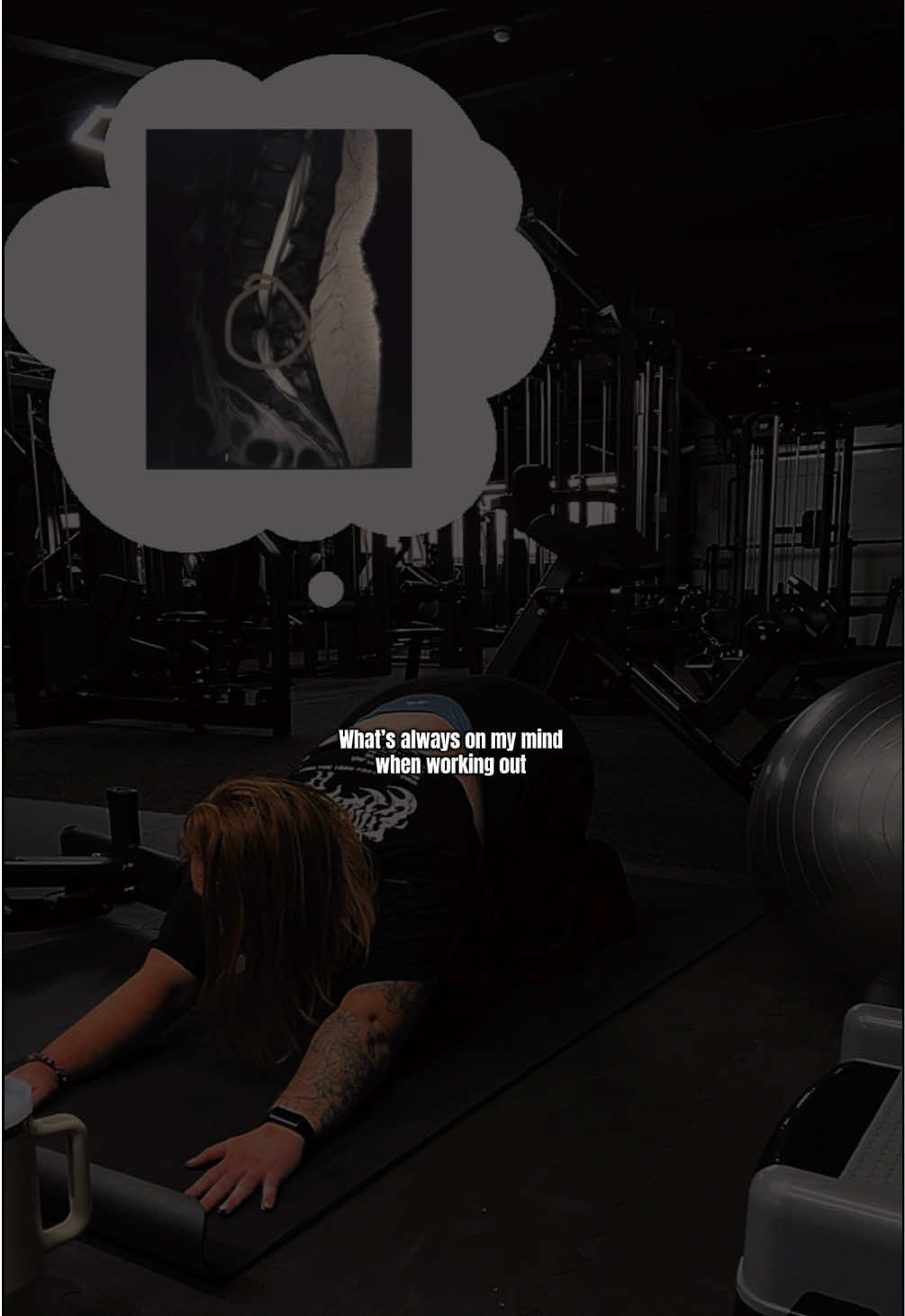 Scary thought of it happening again #slippeddisc #discectomy #fyp #gymgirlsuk #GymReels 