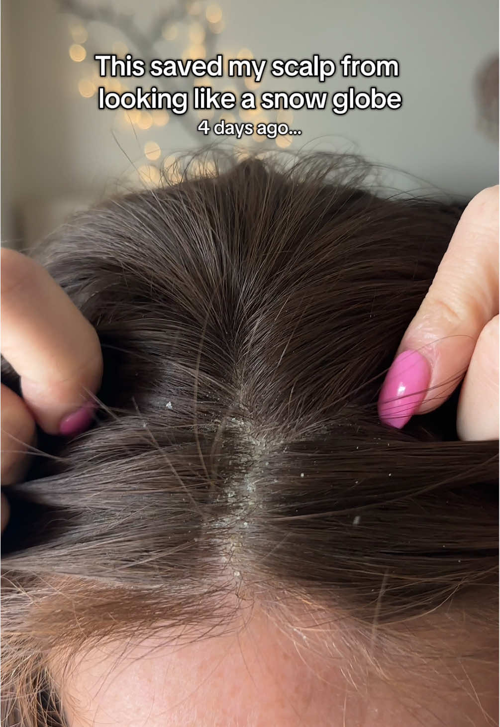 Instant glow up w/ this new scalp care and hair growth shampoo ✨my hair gets dry and dandruff in the dry LA heat so I’ve been on the search for a new shampoo. Also want some hair growth in some areas. So far so good 👏🏻👏🏻 #creatorsearchinsights #scalpcare #dryhair #hairgrowthproducts #hairgrowthshampoo 
