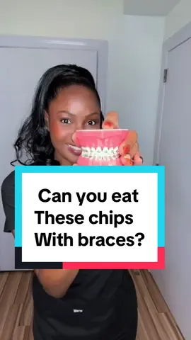 Soft chips are best with braces #chips #braces #LearnOnTikTok #bracestips 