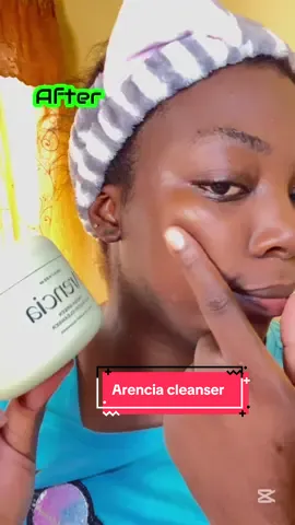 Watch me use this cleanser for 7 days. @Arencia  #MochiGlowUp #Arencia #acnecleanser