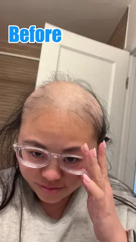 #seapuri #seapuriscalpserum 