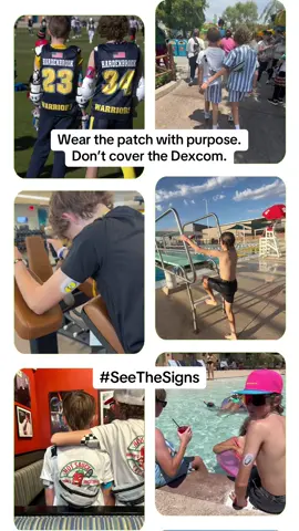 Most people don’t know what they’re looking at. The T1D patch. The Dexcom. The pump. Other Tech.  But when they ask, we get to tell them. That’s how awareness spreads. Early signs of Type 1 Diabetes: • Excessive thirst • Frequent urination • Sudden weight loss • Bedwetting • Extreme fatigue • Irritability #seethesigns #t1dlife #HighsandLowsBros #diabetesawareness #dexcomwarrior 