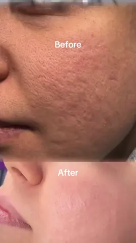 #swat #peshawar #tiktok #fyp #tiktokviral 