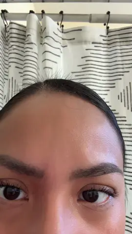 I’m a victim of a hate crime, because I hate pp hair loss 🫠#momtok 