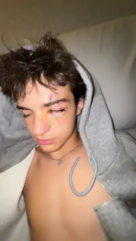 fresh outta surgery #surgery #injury #broken #fyp 