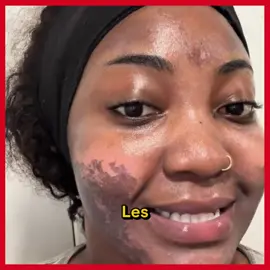 🙈 Chaque matin, vous perdez du temps à redessiner vos sourcils ? Avec Alluma, une seule application suffit pour avoir des sourcils nets, intenses et naturels jusqu’à 7 jours. Résultat immédiat : un avant/après bluffant, sans maquillage quotidien. ✨ Gagnez du temps, de la confiance et dites adieu aux crayons qui s’effacent. 📦 Commandez aujourd’hui et payez directement à la livraison.