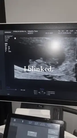 Time is truly a thief #MomsofTikTok #firsttimemom #fyp #babytiktok #newmom 
