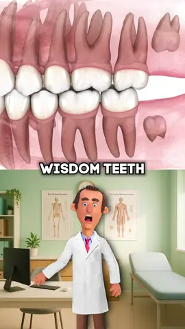 Why Do We Even Have Wisdom Teeth? #health #wisdomteeth 