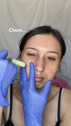 POV: You finally find an ampoule that makes your skin look like you slept 8 hours (even when you didn’t 😴) #easydew #egf #darkspots #kbeauty #skincare 