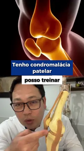 Os exercícios terapêuticos são fundamentais para a condromalácia patelar porque fortalecem os músculos que suportam o joelho, melhoram o alinhamento corporal e a estabilidade da patela, e aumentam a produção de líquido sinovial, o que reduz a dor e o atrito na articulação. Eles ajudam a evitar o agravamento da condição, melhoram a função do joelho e a qualidade de vida do indivíduo, mas devem ser realizados com orientação profissional para evitar exercícios que causem dor. #joelho #condromalaciapatelar #artrose #fisioterapia #exercicio 