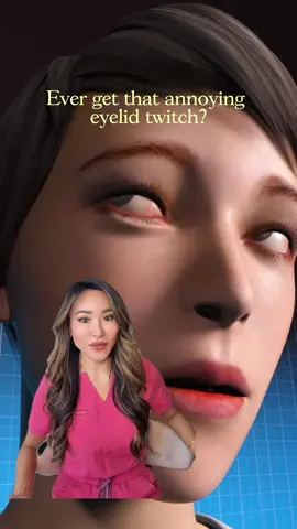 Do you ever get eyelid twitches? It’s called myokymia and here’s what you should do. Tag someone who gets them too ⬇️ #eyecare #relatable #eyelid #viral #optometrist 
