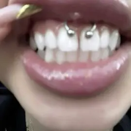 #piercing#smileypiercing#aesthetic#viral#fyp