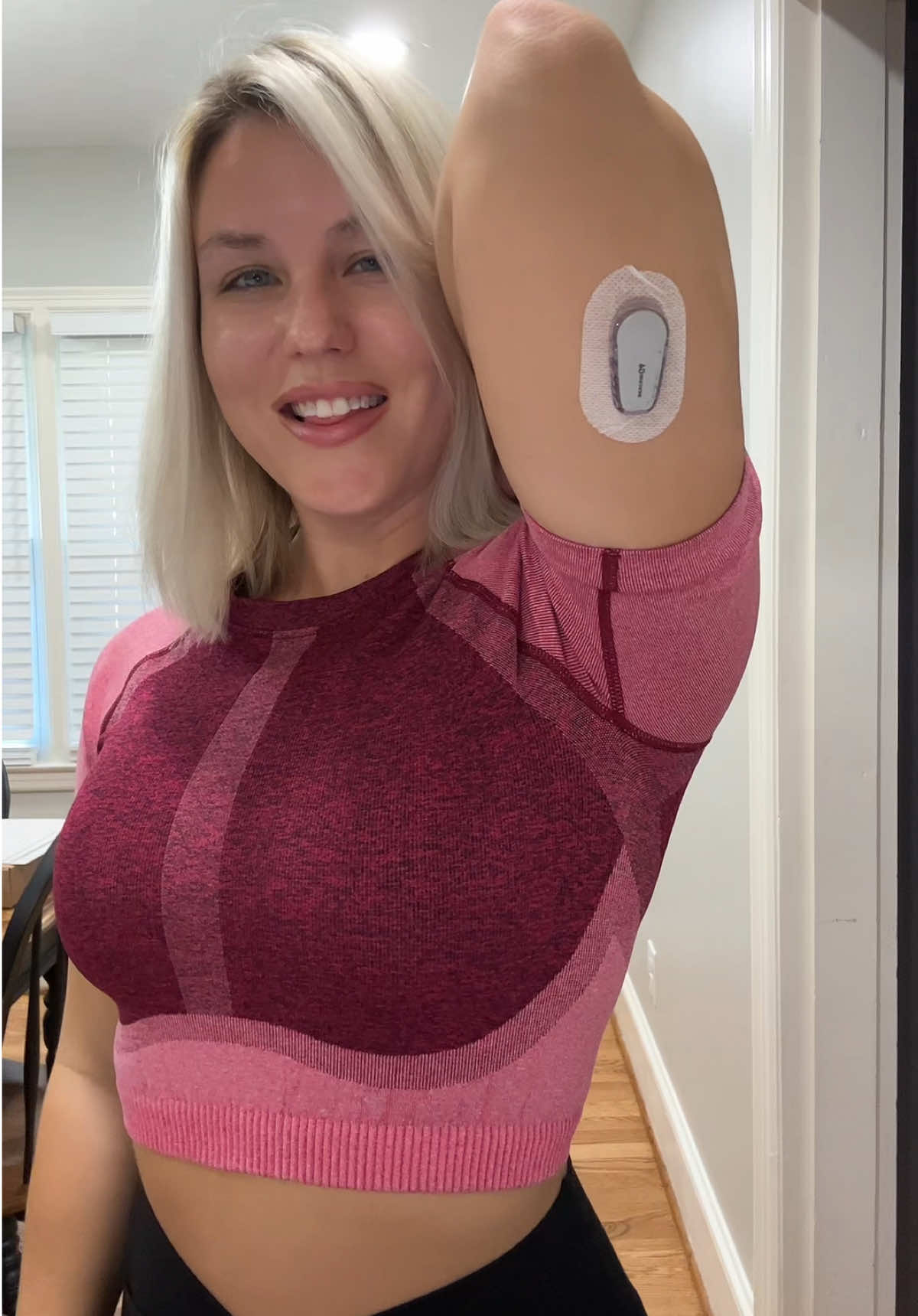 sensor change early because it ripped off my stomach💉 #type1diabetes #sensorchange #dexcomg6 #t1d #diabetestype1 