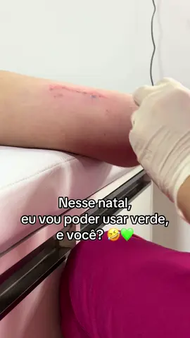 Uma brincadeirinha pra animar esse lugar aqui 🥸🤣💚 #implanon #foryou #fy #fyp #fyppppppppppppppppppppppp 
