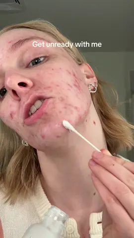 Don’t think you’re supposed to spot treat and use the serum but you live and you learnnnnnn. @Murad Skincare @iunik_us_official @ErborianUSA #acne #spottreatment 