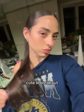 why r they all on my cheeks help