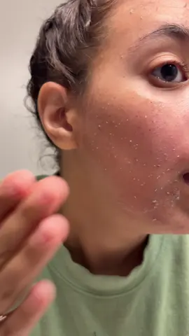 The Medicube Peel Shot is seriously that girl for instant glow @medicube US Store  #medicube #medicubepeelshot #glowyskin #medicubeskincare 