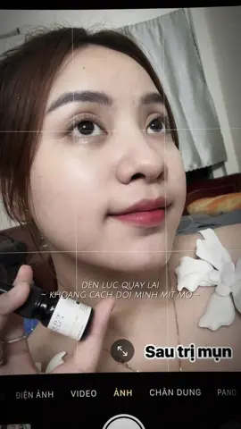 ⚔️ Mụn tới đâu diệt tới đấy  Có Trị Mụn Dr SkinBeauty thì sợ gì mụn 😆 Chiến binh diệt mụn - serum đặc trị mụn Dr SkinBeauty  ✅ Se cồi mụn - sát khuẩn vùng mụn ✅ Diệt tận gốc nhân mụn - không để mụn tái phát ✅ Làm khoẻ da - dày mô da, phục hồi da tổn thương do mụn 100% khách hàng phản hồi làn da tốt lên 70-80% chỉ sau một liệu trình 🍃 Dr SkinBeauty - bảo bối chăm da của chị em mình 🤎 📍Feedback chất lượng tuyệt đốiii từ vị trí khách nhà em ✅ #trimun #lamdep 