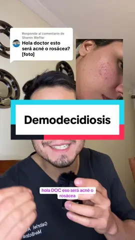 Respuesta a @Sharon Weffer #demodex #rosacea #acne