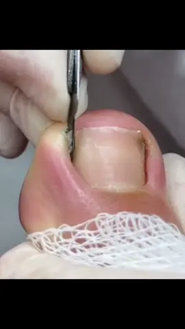 #fyyyyyyyyyyyyyyyyyyy #fypシ゚viral #nailsoftiktok #unhaencravada #unhaencravada 