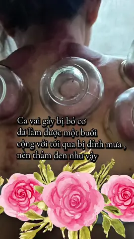 #xuhuong #viral #yhoccotruyen #ThạchThảo #Cạogiógiáchơi 