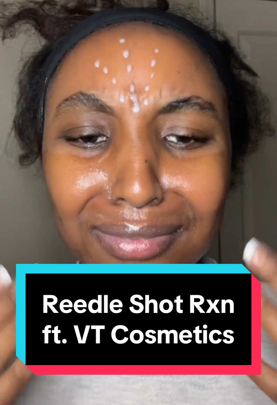 it’s viral in Korea so I had to check it out. Check my showcase!  #microneedling in a bottle by @VT Cosmetics US   I should have started with the 1300; however I didn’t think it hurt as bad. Definitely using the 100 more often! I do not recommend using the 1300 to start or using the 1300 more than just for spot treatment. It actually hurts…a lot! But the glow from both the 100 and 1300 are *chefs kiss*  #koreanskincare #kbeauty #vtcosmetics #reedleshot @4am.kr #ulta   