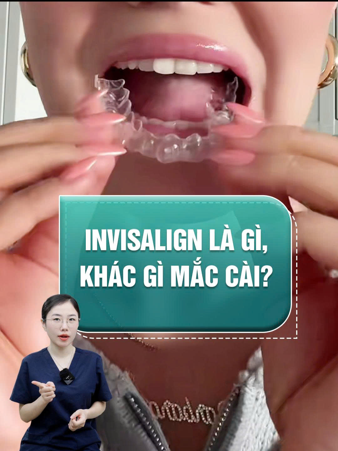 Invisalign là gì? Vò sao nó lại đắt#Nhakhoaquoctevietphap #niềng_răng #xuhuongtiktok #braces #xuhuong