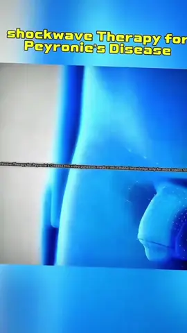 #health #trending #foryou #followers😘thank U