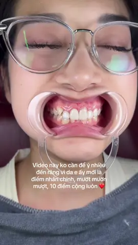 Video này ko cần để ý nhiều đến răng vì da e ấy mới là điểm nhấn chính, mướt mườn mượt, 10 điểm cộng luôn ❤️