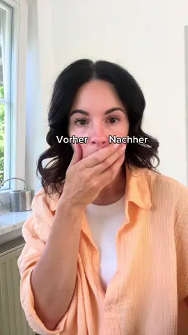 Anzeige * Sofort-Effekt für einen strahlenden Blick: Das @L’Oréal Paris Revitalift Laser Anti Tränensack Sofort Lifting lässt deine Tränensäcke in 15 Minuten verschwinden! ✨ Tränensäcke Ade!  #lorealparisskincare #lorealparispartner #traenensaecke #hautpflegeab40