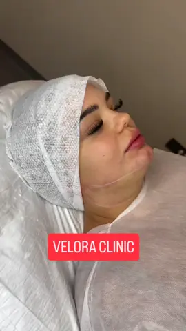 #chincontouring #istanbulclinic #doublechinremoval #gidi #noninvasivetreatment #foryou #göz #augenbrauentransplantation #germany #kas #deutschland #hallo #beauty #skincare #SelfCare #viral #transformation 